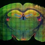 هذه آلية تكوين الذكريات في الدماغ