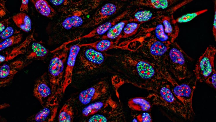 باحثون يبتكرون "جنود خارقون" معدلين للحمض النووي لمحاربة السرطان