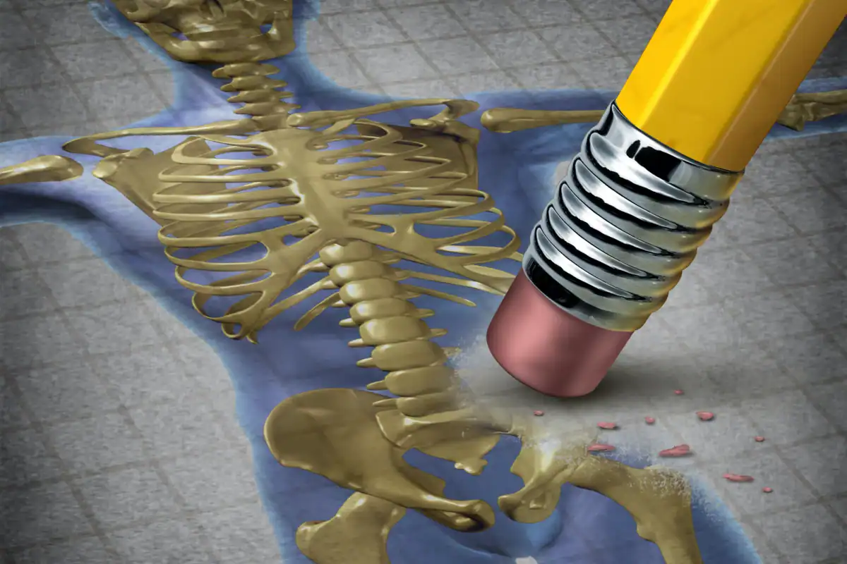 هل يمكن أن يقدم الهرمون الطبيعي علاجًا أفضل لهشاشة العظام؟