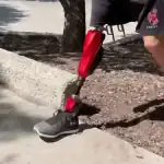 Utah Bionic Leg.. أطراف صناعية تعمل بالذكاء الاصطناعي
