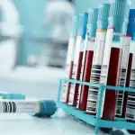 الولايات المتحدة تستعد لإطلاق اختبارات الدم التي تكشف أنواع متعددة من السرطان