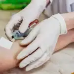 دراسة: فائدة الكوليسترول الجيد تختلف حسب العرق