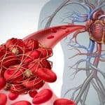 ابتكار روبوتات نانوية لعالج تجلط الدم