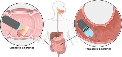 اختراع حبوب ذكية يمكنها أن تؤدي مهام المنظار لتحديد مشاكل الجهاز الهضمي  