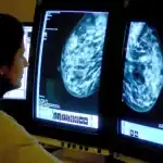 اكتشاف طريقة جديدة للوقاية من سرطان الثدي