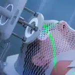 دراسة: مادة هلامية جديدة تعد بالقضاء على سرطان الدماغ إلى الأبد