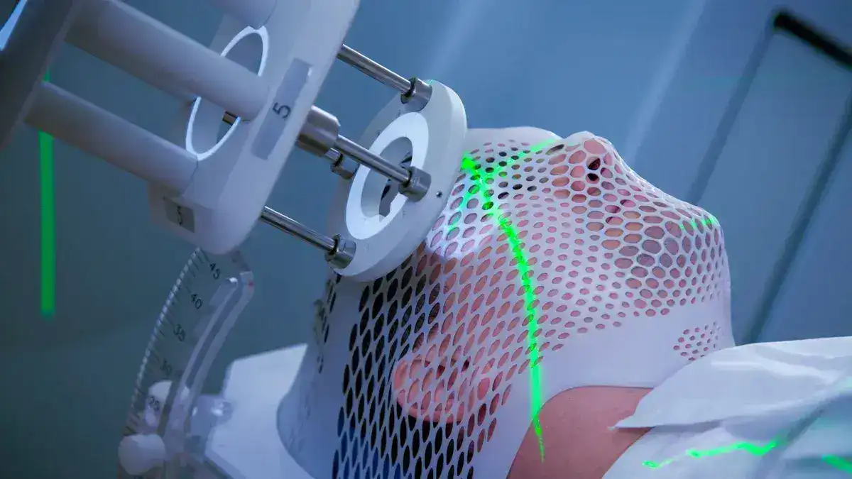 دراسة: مادة هلامية جديدة تعد بالقضاء على سرطان الدماغ إلى الأبد