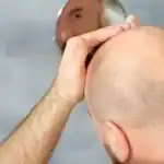 بشرى للصُلع.. اختراق جين يحفز نمو الشعر