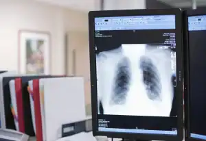 أكتشاف الامراض بواسطة روبوتات الدردشة