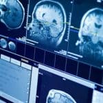 إيزولت أقوى جهاز تصوير بالرنين المغناطيسي في العالم يلتقط أولى صور مذهلة للدماغ..ما القصة؟