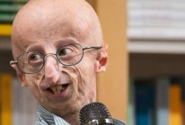 الشيخوخة المبكرة