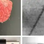 الأشعة السينية