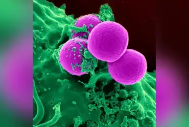 جرثومة تتحمل الإشعاع القاتل للإنسان