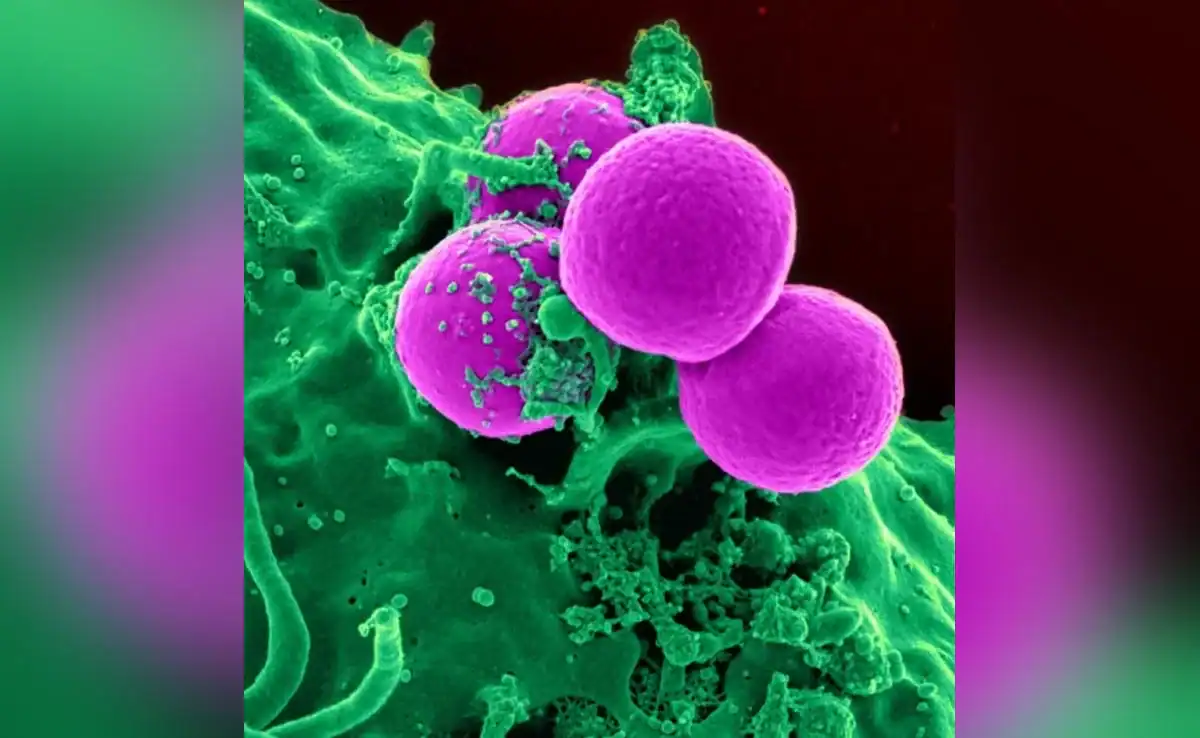 جرثومة تتحمل الإشعاع القاتل للإنسان