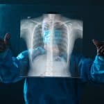 الذكاء الاصطناعي يقرأ أشعة الصدر